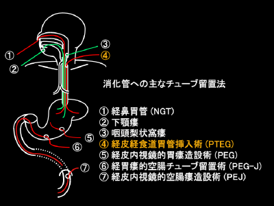 活動報告写真